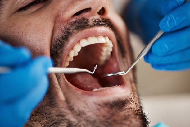 Best Emergency Denture Repair in South Bay, FL