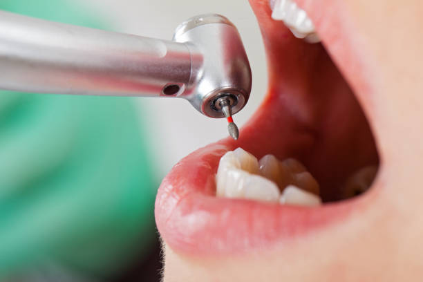 Best Emergency Cosmetic Dentistry (e.g., broken veneers) in South Bay, FL